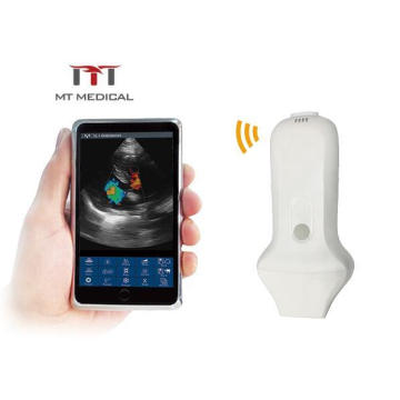 Color Doppler Tablet Ultrasound Handheld Color Ultrasound Scanner Android Ultrasound Probe